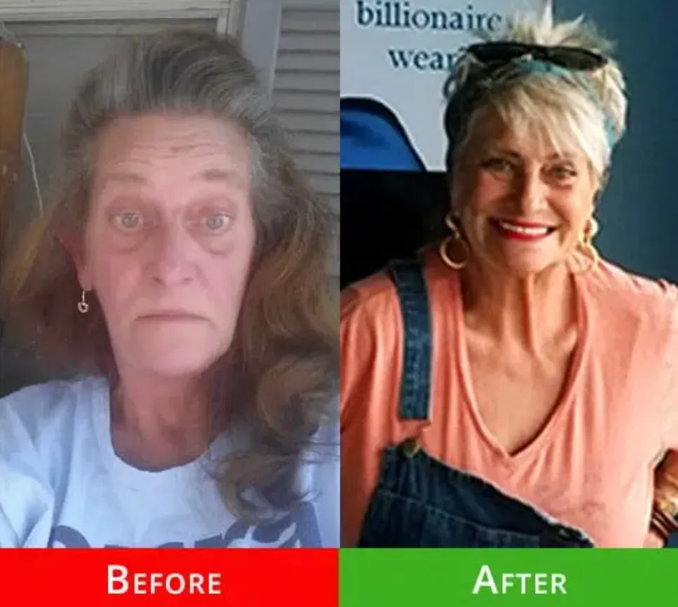 Before and after sobriety transformation of a woman in addiction recovery through Nova Recovery Center